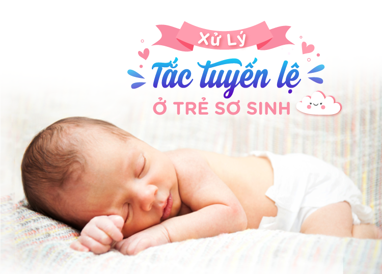 XỬ LÝ TẮC TUYẾN LỆ Ở TRẺ SƠ SINH