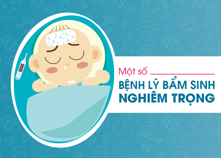MỘT SỐ BỆNH LÝ BẨM SINH NGHIÊM TRỌNG