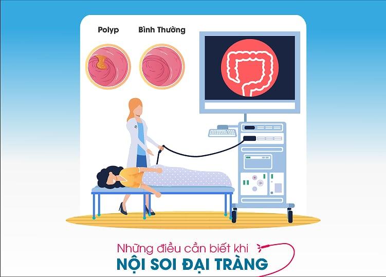 NHỮNG ĐIỀU CẦN BIẾT KHI NỘI SOI ĐẠI TRÀNG