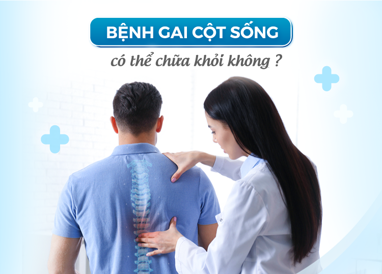 BỆNH GAI CỘT SỐNG CÓ THỂ CHỮA KHỎI KHÔNG?