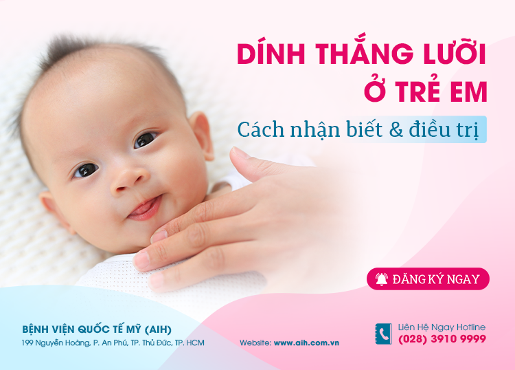 DÍNH THẮNG LƯỠI Ở TRẺ EM, CÁCH NHẬN BIẾT VÀ ĐIỀU TRỊ HIỆU QUẢ