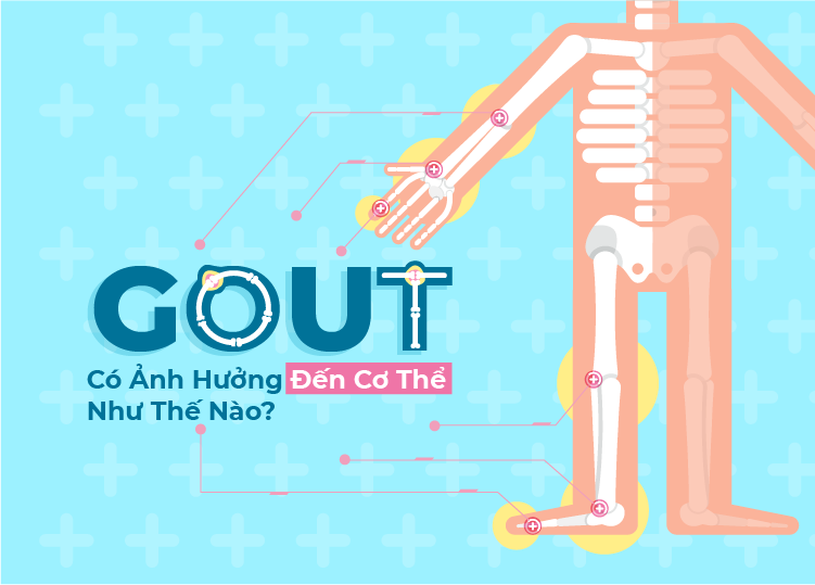 BỆNH GOUT CÓ ẢNH HƯỞNG ĐẾN CƠ THỂ NHƯ THẾ NÀO?