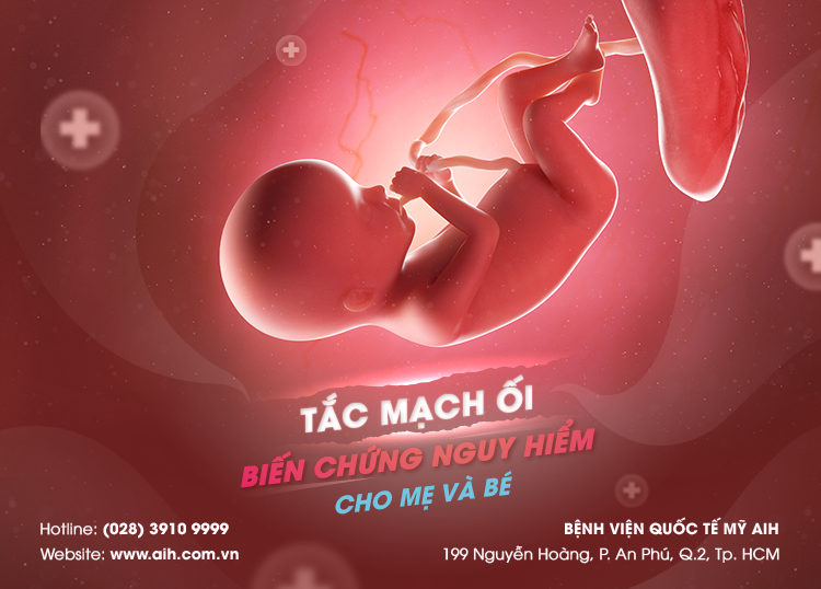 TẮC MẠCH ỐI: BIẾN CHỨNG NGUY HIỂM CẢ MẸ VÀ BÉ