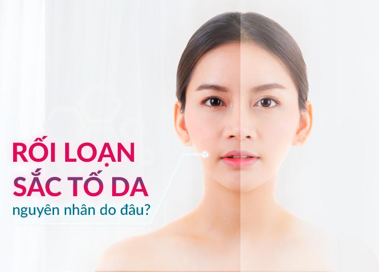 RỐI LOẠN SẮC TỐ DA | NGUYÊN NHÂN DO ĐÂU?