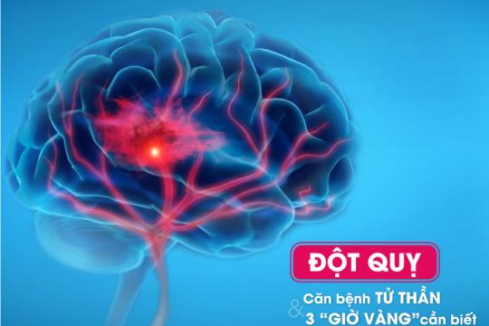 ĐỘT QUỴ - CĂN BỆNH TỬ THẦN VÀ 3 “GIỜ VÀNG” CẦN BIẾT