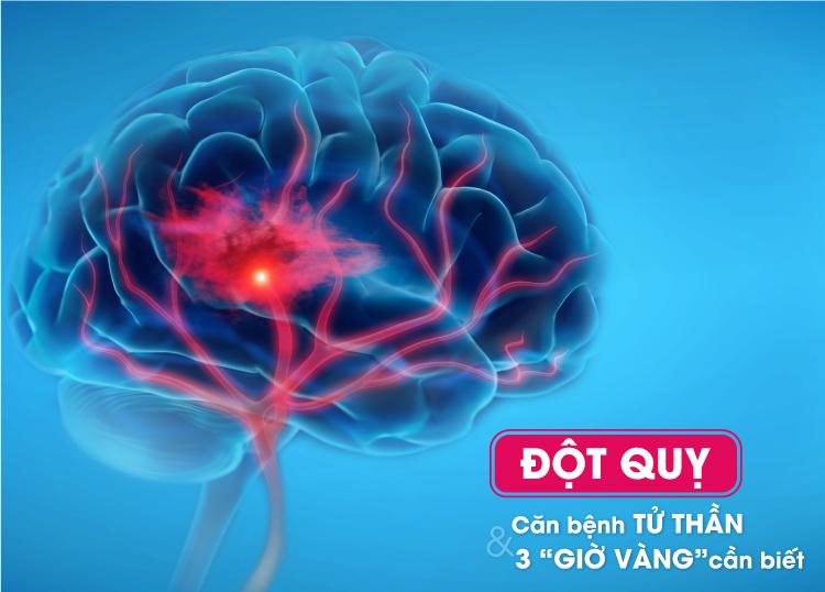 ĐỘT QUỴ - CĂN BỆNH TỬ THẦN VÀ 3 “GIỜ VÀNG” CẦN BIẾT