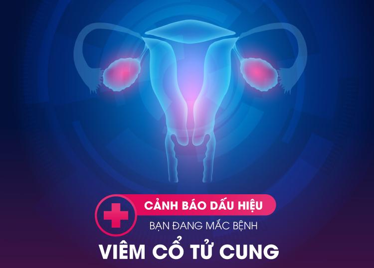 WARNING SIGNS OF CERVICITIS