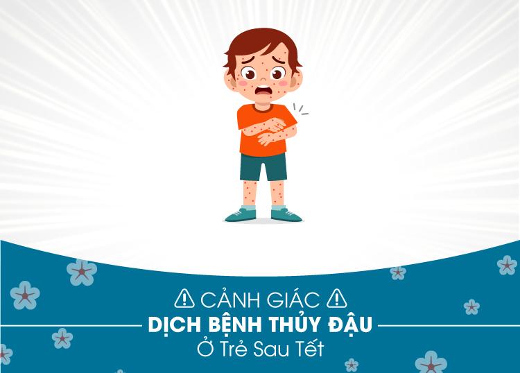 CẢNH GIÁC DỊCH BỆNH THỦY ĐẬU Ở TRẺ SAU TẾT