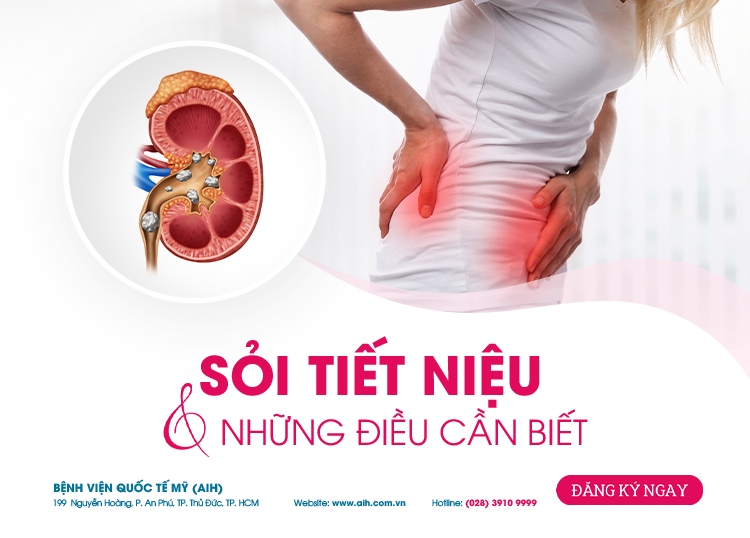 SỎI TIẾT NIỆU & NHỮNG ĐIỀU CẦN BIẾT