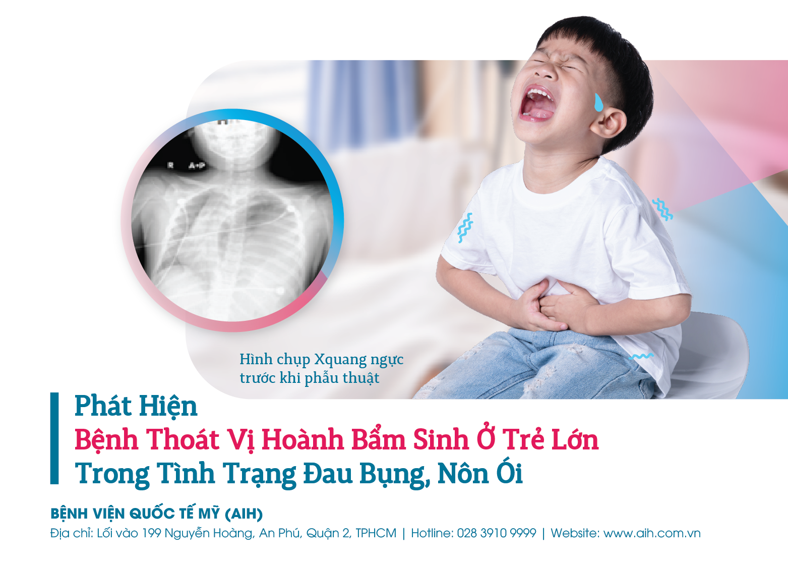 BỆNH THOÁT VỊ HOÀNH BẨM SINH HIẾM GẶP Ở TRẺ LỚN