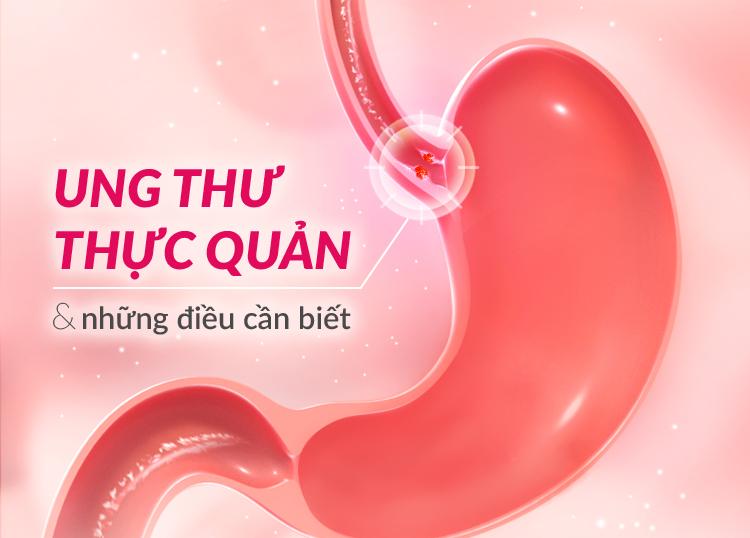 UNG THƯ THỰC QUẢN & NHỮNG ĐIỀU CẦN BIẾT