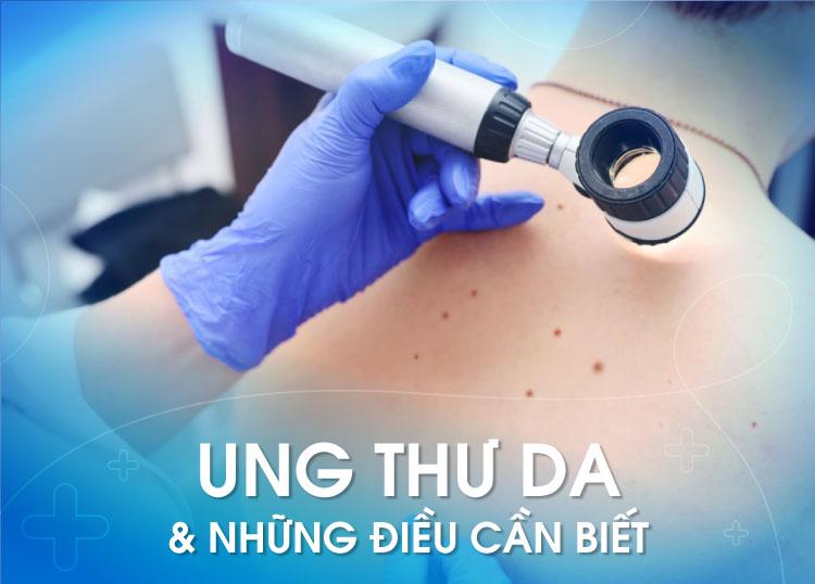 UNG THƯ DA & NHỮNG ĐIỀU CẦN BIẾT