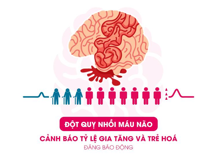 ĐỘT QUỴ NHỒI MÁU NÃO | CẢNH BÁO TỈ LỆ GIA TĂNG VÀ TRẺ HOÁ ĐÁNG BÁO ĐỘNG