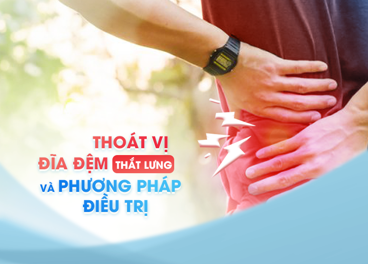 THOÁT VỊ ĐĨA ĐỆM THẮT LƯNG VÀ PHƯƠNG PHÁP ĐIỀU TRỊ