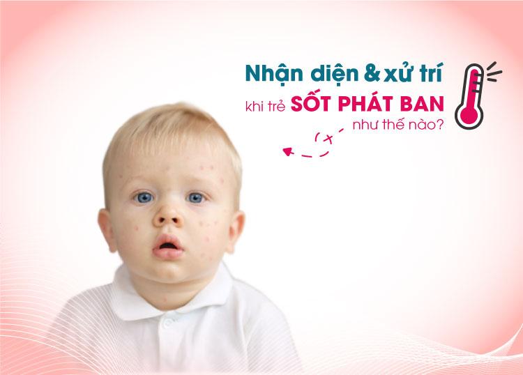 NHẬN DIỆN VÀ XỬ TRÍ KHI TRẺ SỐT PHÁT BAN NHƯ THẾ NÀO?