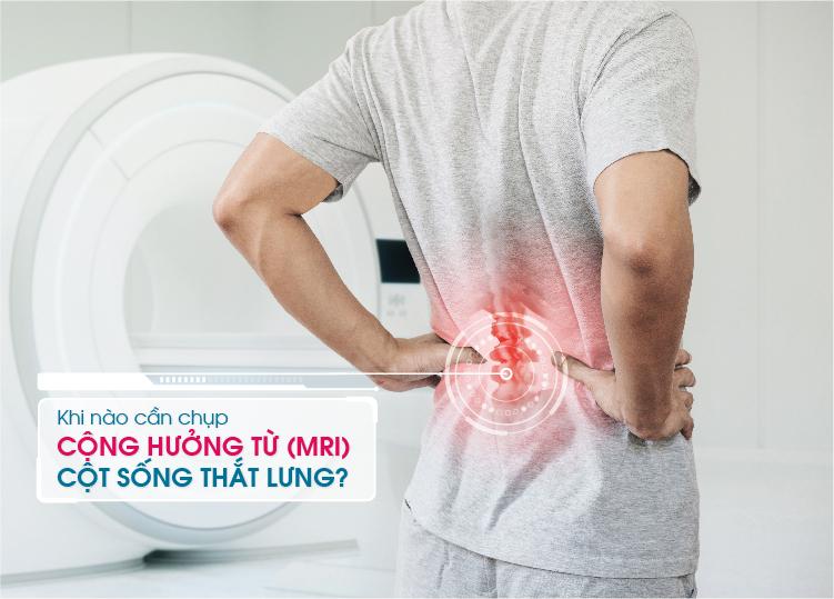 KHI NÀO CẦN CHỤP CỘNG HƯỞNG TỪ (MRI) CỘT SỐNG THẮT LƯNG?