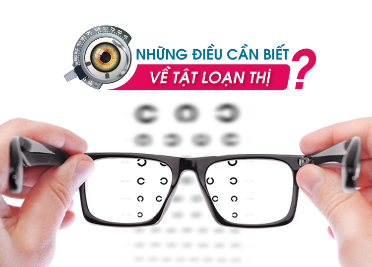 NHỮNG ĐIỀU CẦN BIẾT VỀ TẬT LOẠN THỊ
