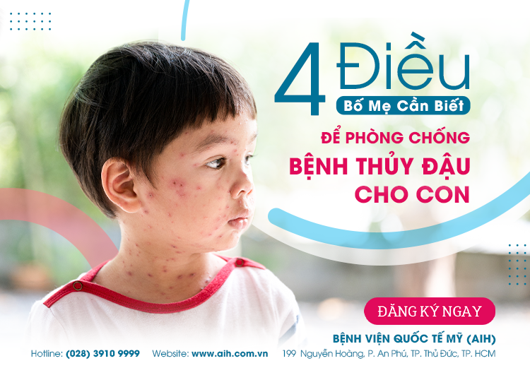 4 CÁCH GIÚP BỐ MẸ PHÒNG NGỪA BỆNH THỦY ĐẬU CHO TRẺ