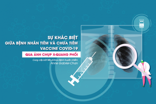 DIFFERENCES IN CHEST X-RAY IMAGES BETWEEN COVID-19 VACCINATED AND UNVACCINATED PATIENTS