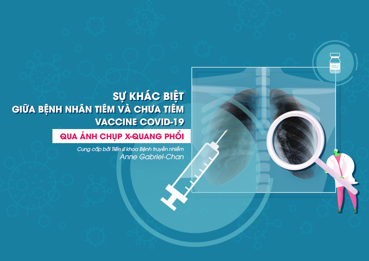 SỰ KHÁC BIỆT GIỮA BỆNH NHÂN TIÊM VÀ CHƯA TIÊM VACCINE COVID-19 QUA ẢNH CHỤP X-QUANG PHỔI