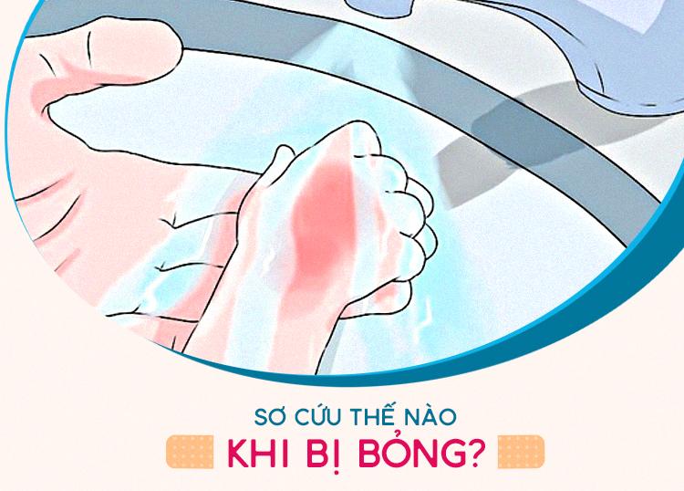 SƠ CỨU THẾ NÀO KHI BỊ BỎNG?