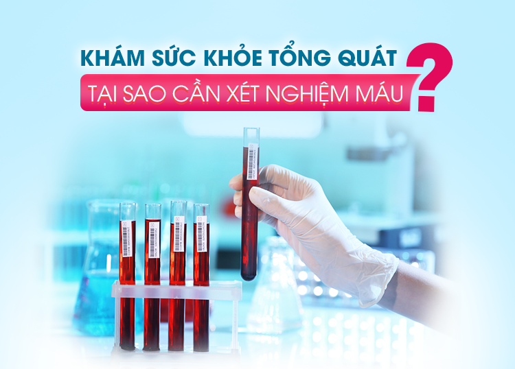 GENERAL HEALTH CHECK-UP: WHY DO YOU NEED A BLOOD TEST?