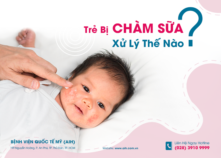 TRẺ BỊ CHÀM SỮA, XỬ LÝ THẾ NÀO?