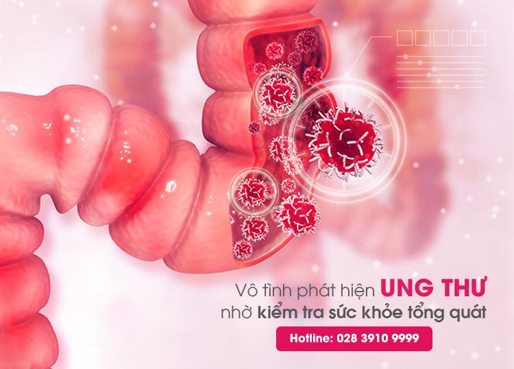 VÔ TÌNH PHÁT HIỆN UNG THƯ GIAI ĐOẠN SỚM NHỜ KIỂM TRA SỨC KHỎE TỔNG QUÁT!