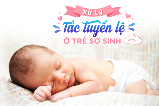 NEONATAL LACRIMAL DUCT OBSTRUCTION MANAGEMENT