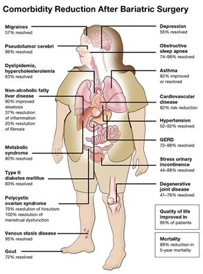 comorbidity reduction after bariatric surgery