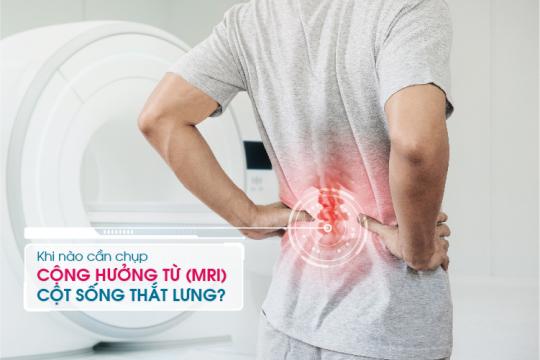 KHI NÀO CẦN CHỤP CỘNG HƯỞNG TỪ (MRI) CỘT SỐNG THẮT LƯNG?